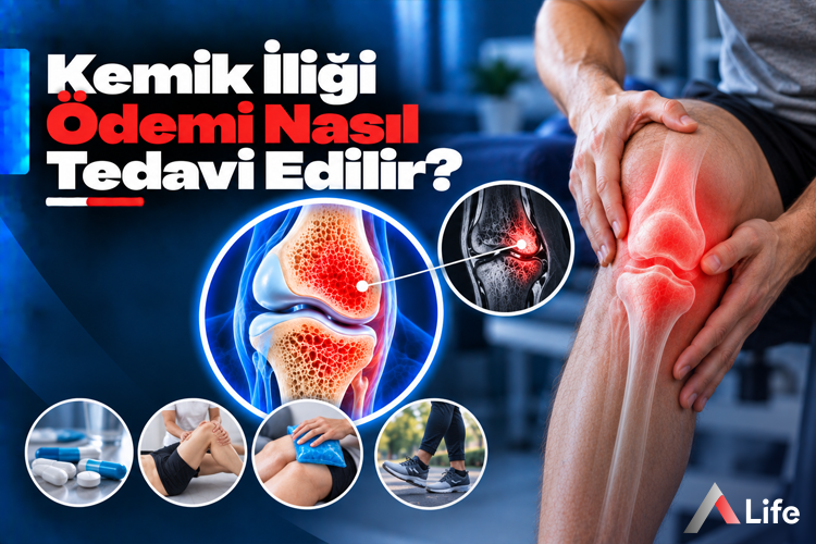 kemik-iligi-odemi-nasil-tedavi-edilir_1ad9355f.webp