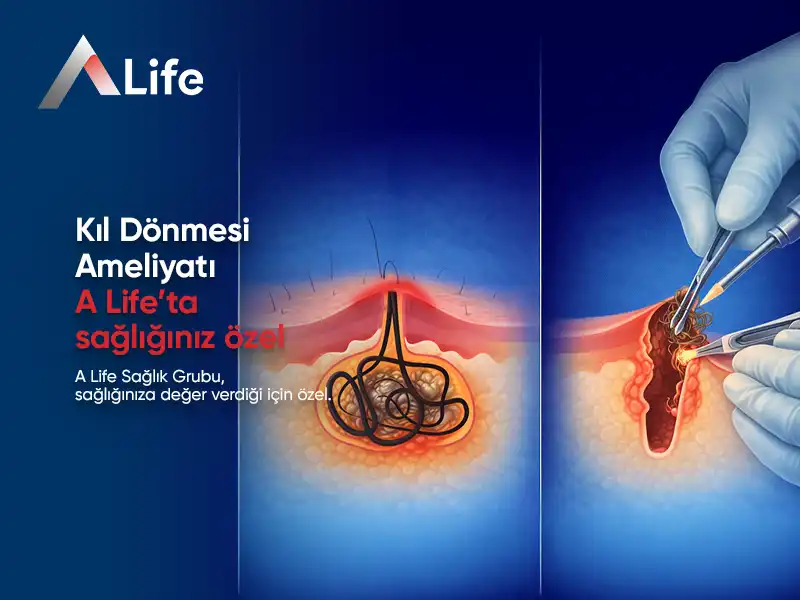 Kıl Dönmesi Ameliyatı