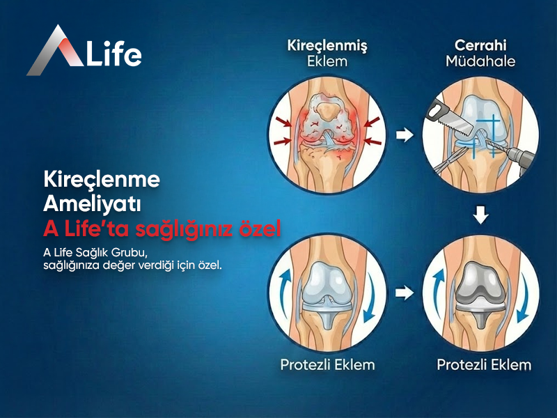 Kireçlenme Ameliyatı