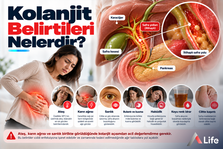 kolanjit-belirtileri-nelerdir_d85db404.webp