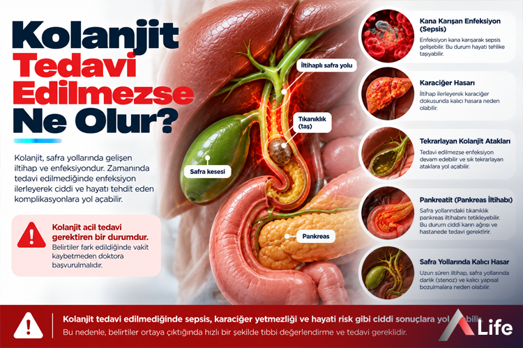 kolanjit-tedavi-edilmezse-ne-olur_664e1b0f.webp
