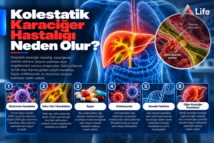 kolestatik-karaciger-hastaligi-neden-olur_e113c610.webp