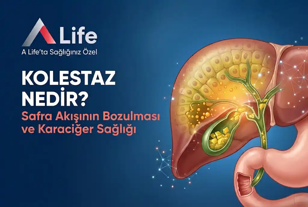 kolestaz-nedir-safra-karaciger-sagligi-a-life-ankara_e60f7942.webp
