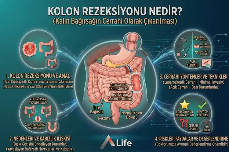 kolon-rezeksiyonu-nedir_e9403876.webp