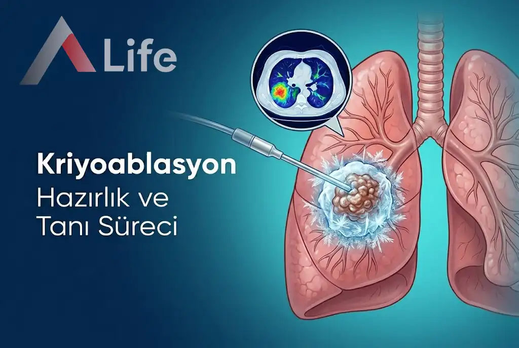 kriyoablasyon-nasil-uygulanir-hazirlik-ve-tani-sureci-a-life-ankara_0781bbbe.webp