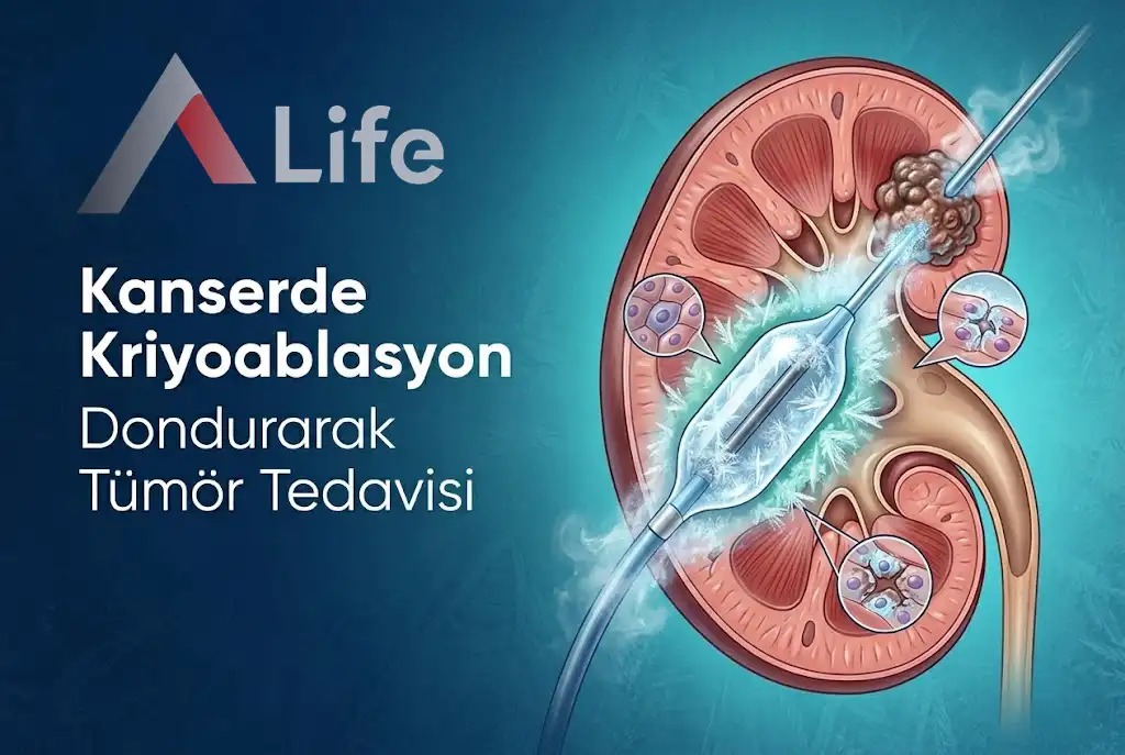 kriyoablasyon-tedavisi-hangi-alanlarda-kullanilir-kanser-uygulamalari-a-life-ankara_24694614.webp