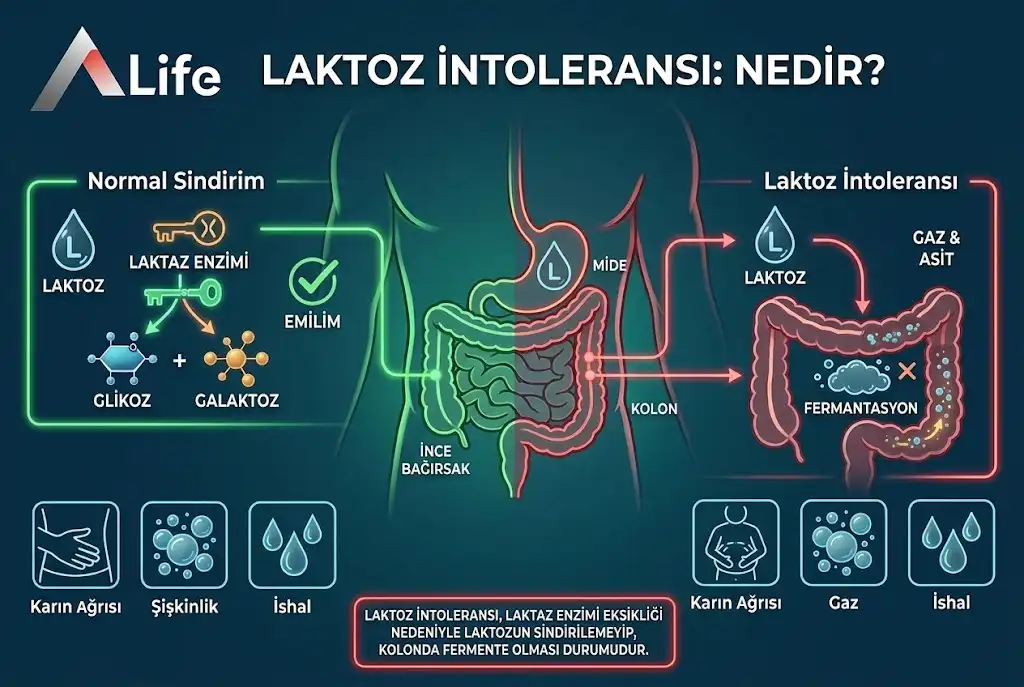Laktoz İntoleransı Nedir? Laktoz Hassasiyeti ve Belirtileri