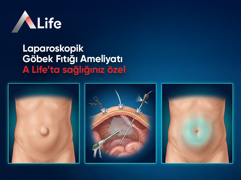 Laparoskopik Göbek Fıtığı Ameliyatı