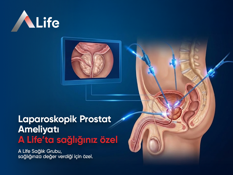 Laparoskopik Prostat Ameliyatı