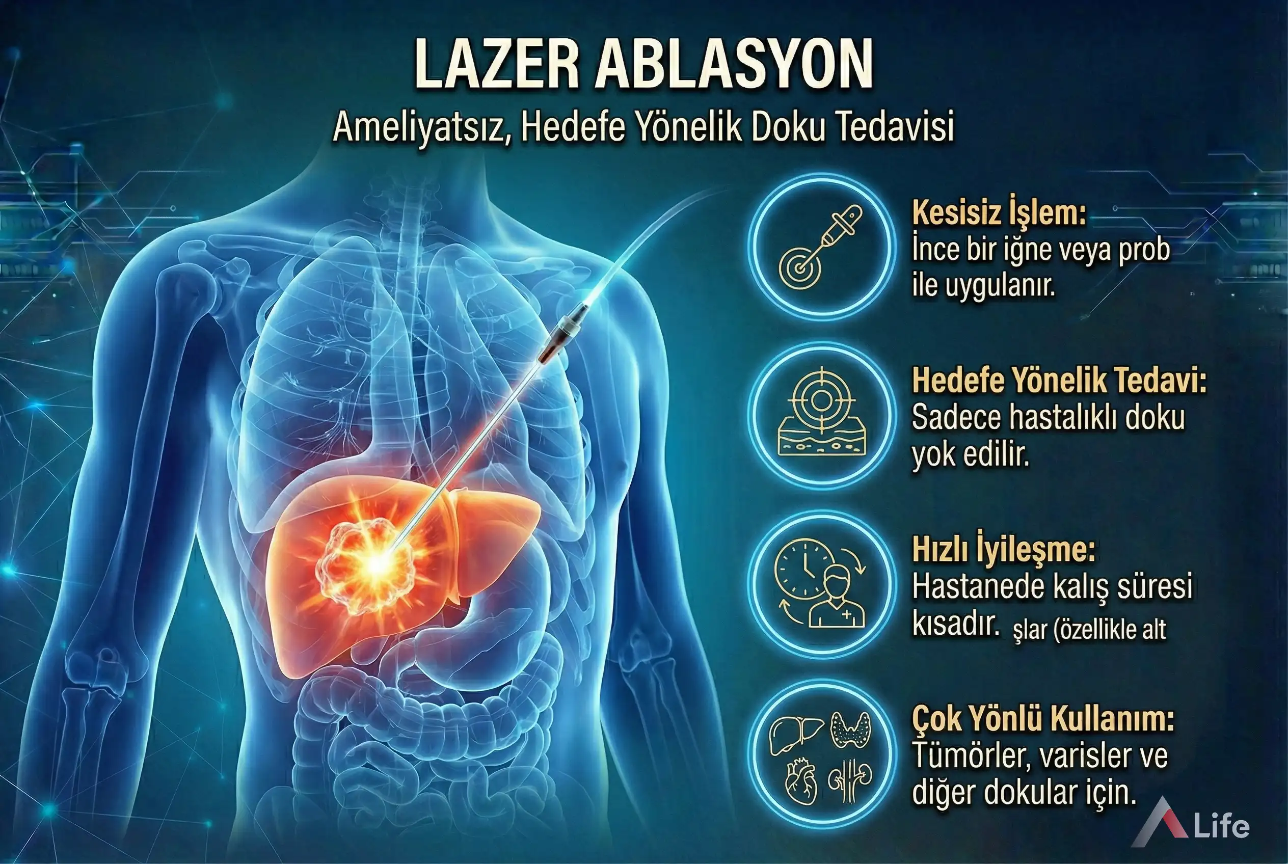 lazer-ablasyon-nedir-a-life-ankara_f1b93f51.webp