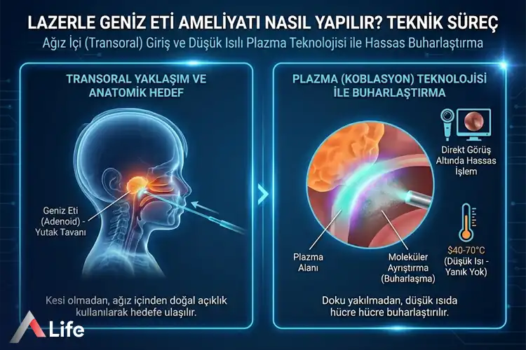 lazerle-geniz-eti-ameliyati-nasil-yapilir_a19575ca.webp