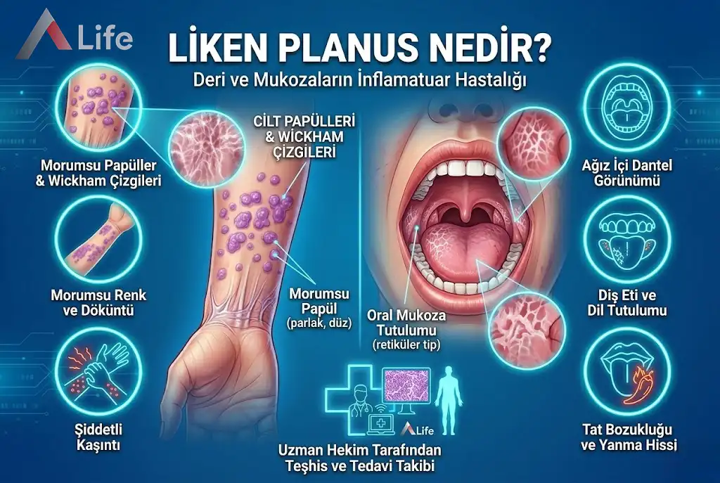 Liken Planus Nedir?