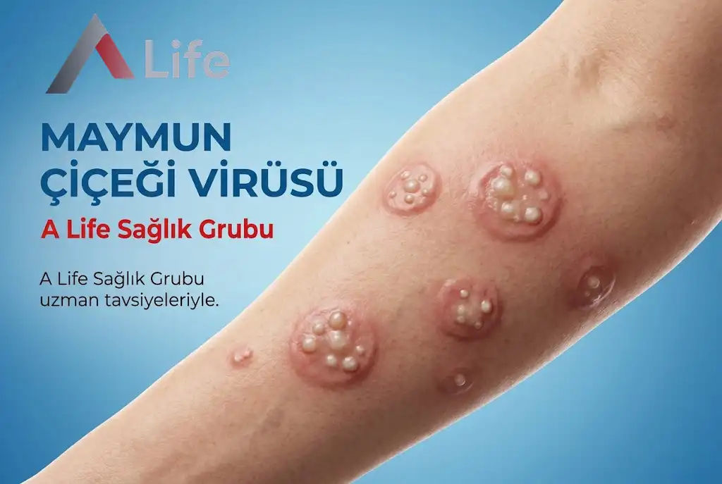 Maymun Çiçeği Virüsü Hakkında ?