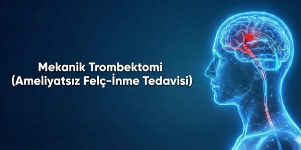 Mekanik Trombektomi (Ameliyatsız Felç Tedavisi)