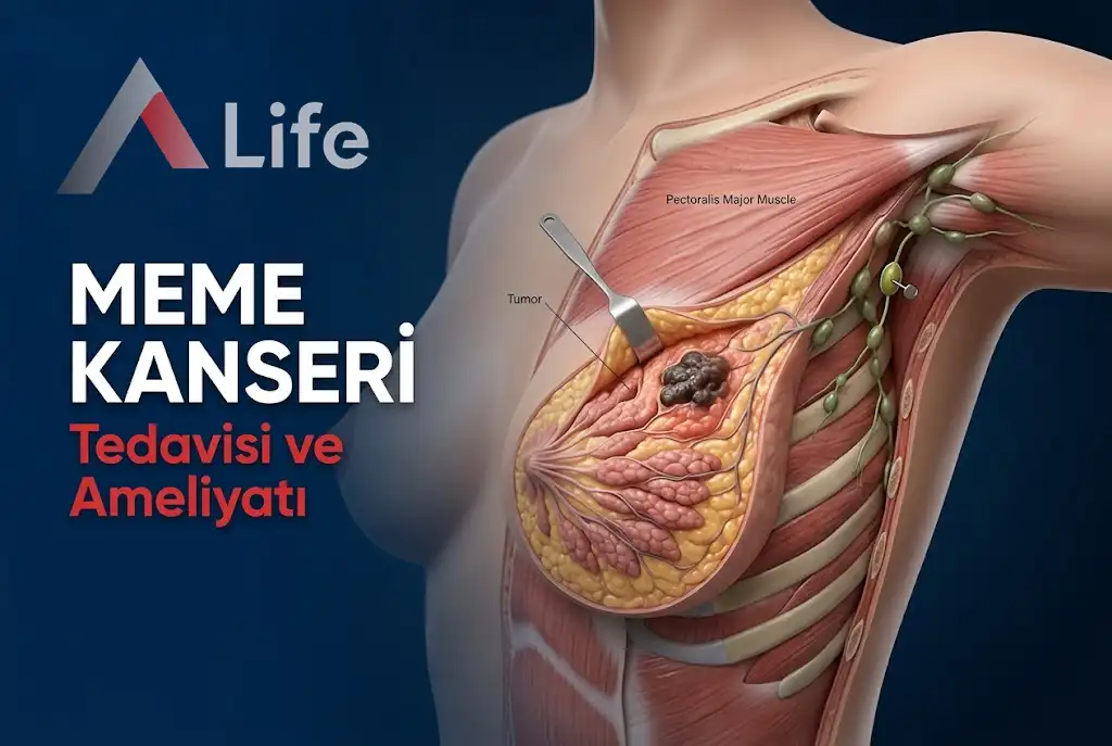 meme-kanseri-tedavisi-ve-ameliyati-a-life-ankara_7691f711.webp