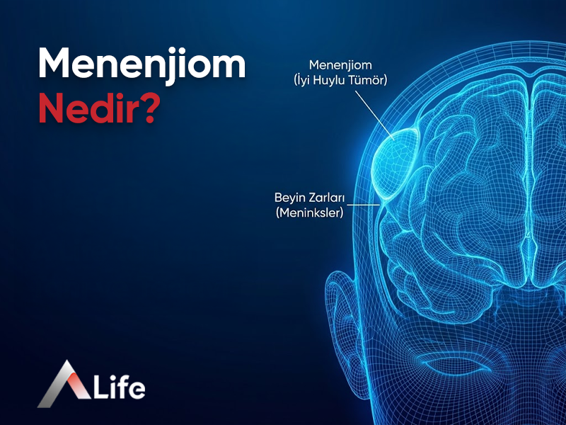 Menenjiom