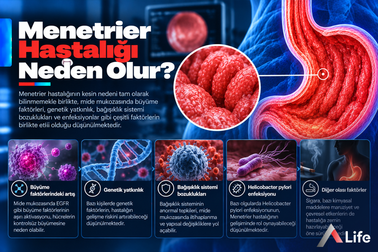 menetrier-hastaligi-neden-olur_6715f8ad.webp