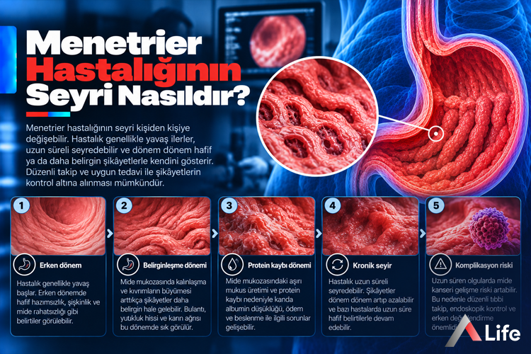 menetrier-hastaliginin-seyri-nasildir_695ee43f.webp