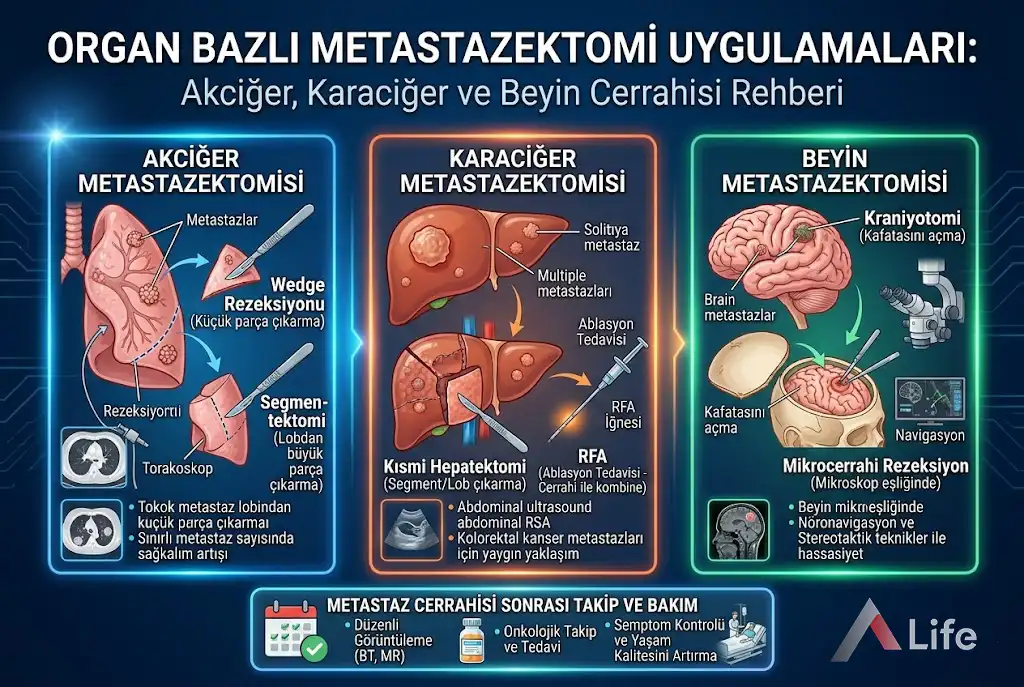 metastazektomi-nedir-metastatik-kanserlerde-cerrahi-teknikler-minimal-invaziv-t__m__r-akciger-karaciger-beyin-cerrahisi-kanser-a-life-ankara_c2b53473.webp