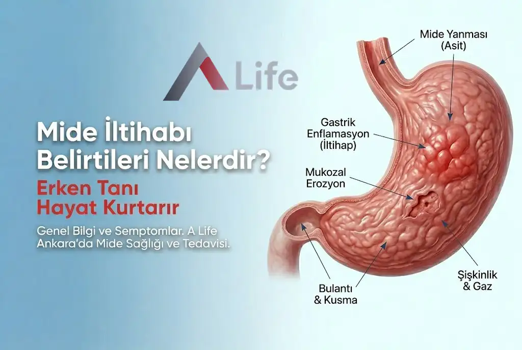 mide-iltihabi-belirtileri-nelerdir-a-life-ankara_8e1c8702.webp