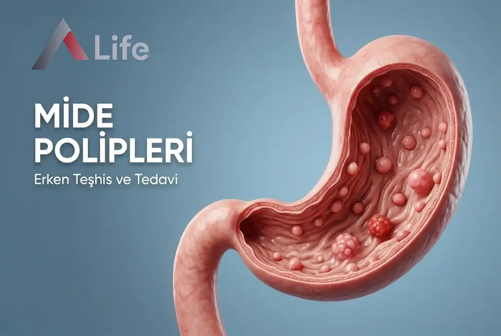 Mide Polipleri
