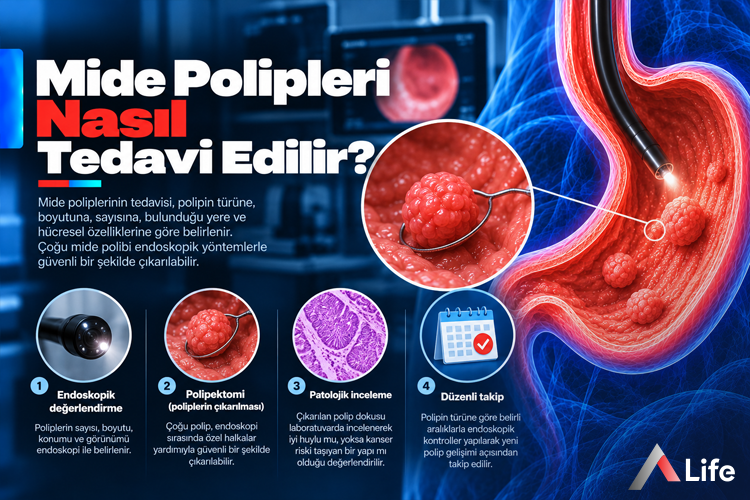 mide-polipleri-nasil-tedavi-edilir_813ad2dd.webp