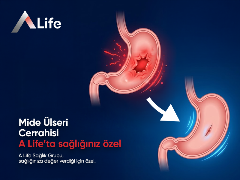 Mide Ülseri Cerrahisi