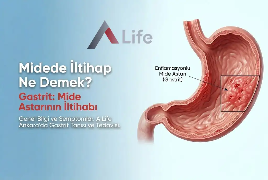 midede-iltihap-ne-demek-a-life-ankara_05e7b24e.webp