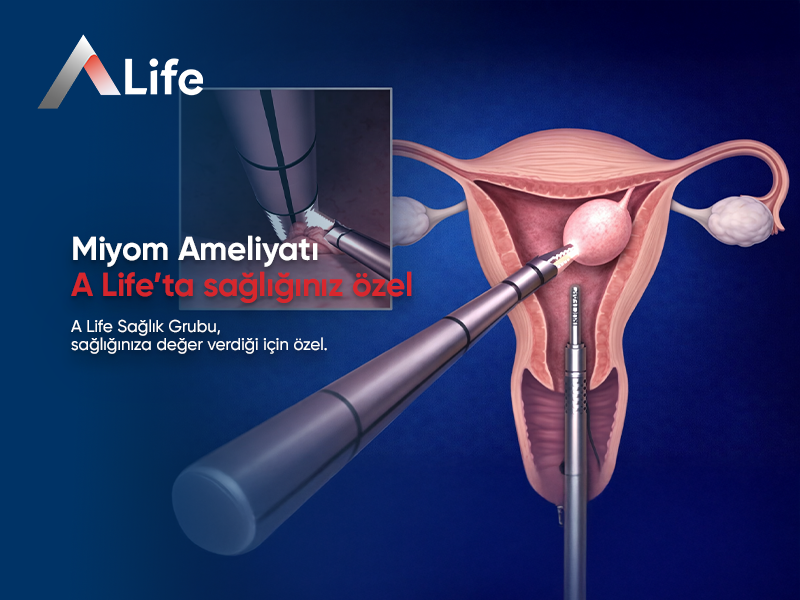 Miyom Ameliyatı