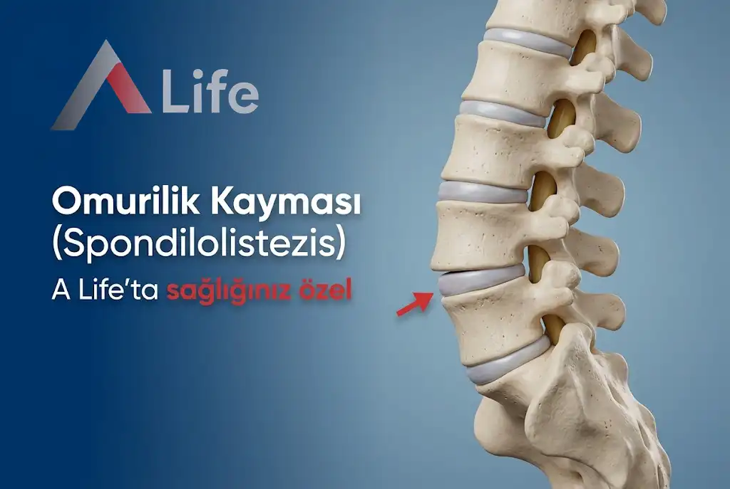 Omurilik Kayması