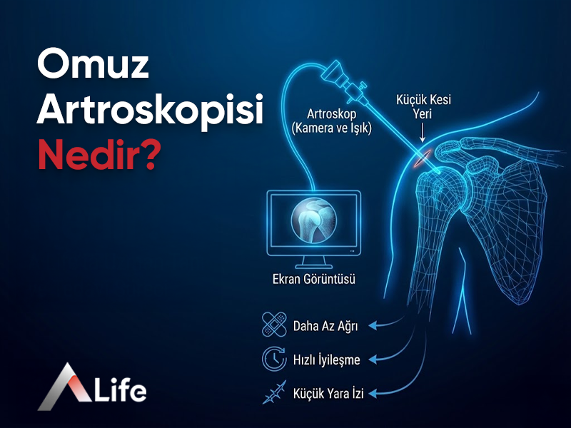 Omuz Artroskopisi Nedir