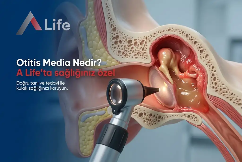Otitis Media Nedir ?