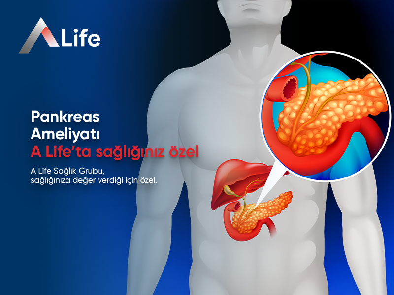 Pankreas Ameliyatı