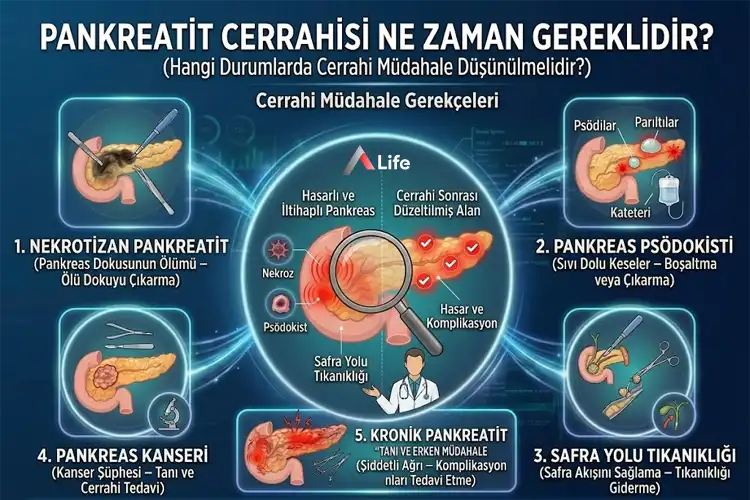 pankreatit-cerrahisi-ne-zaman-gereklidir_ff02b3ae.webp