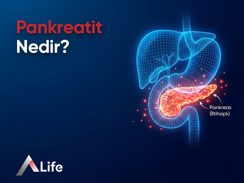 Pankreatit