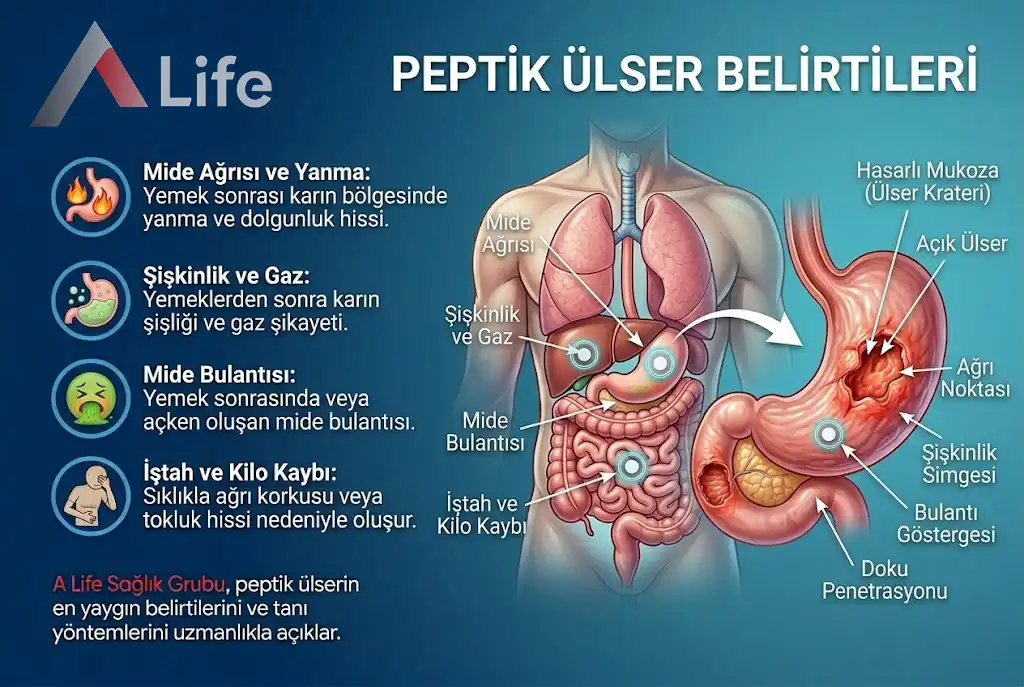 peptik-ulser-belirtileri-a-life-ankara_50efb72b.webp