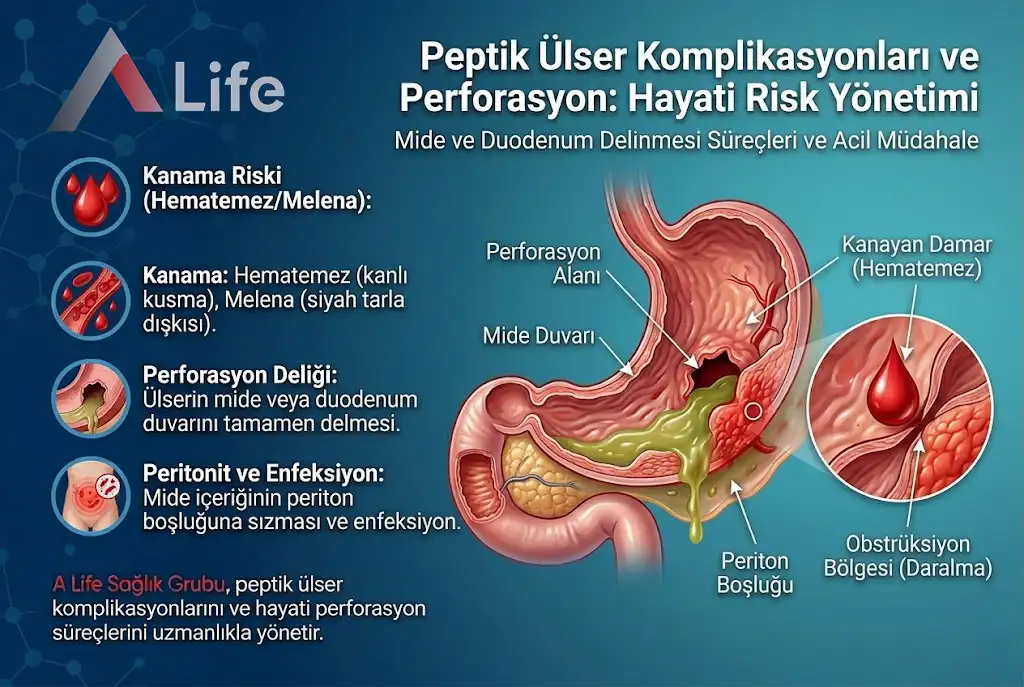 peptik-ulser-komplikasyonlari-ve-perforasyon-a-life-ankara_7071b813.webp