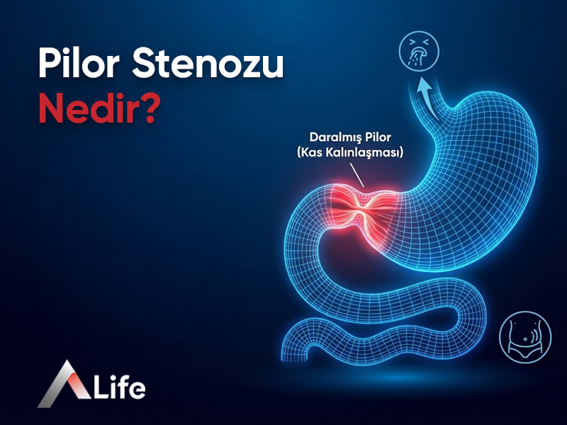Pilor Stenozu