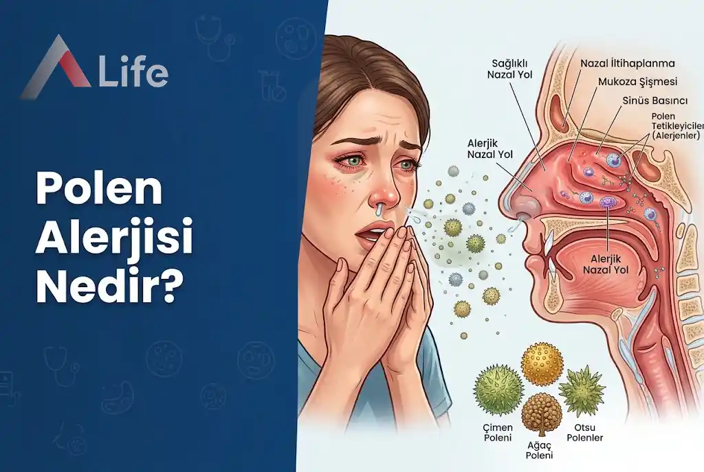polen-alerjisi-nedir-a-life-ankara_d7a20341.webp