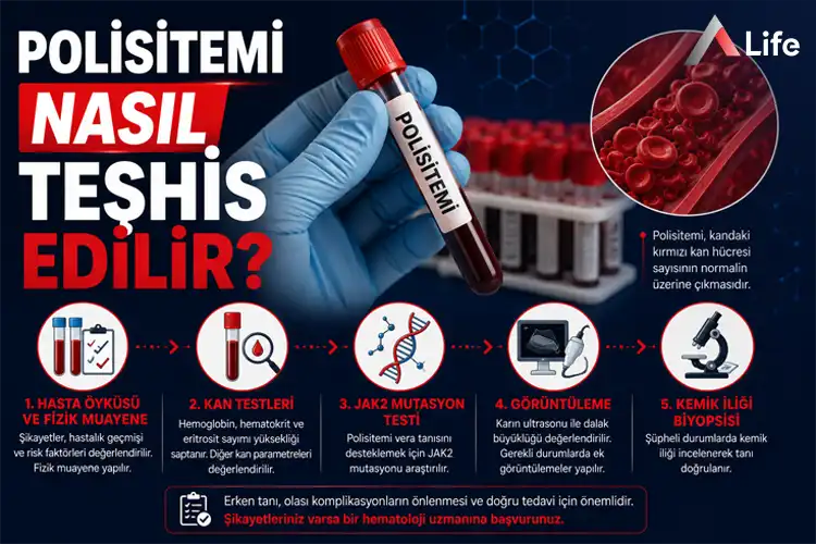 polisitemi-nasil-teshis-edilir_0bb8fc21.webp