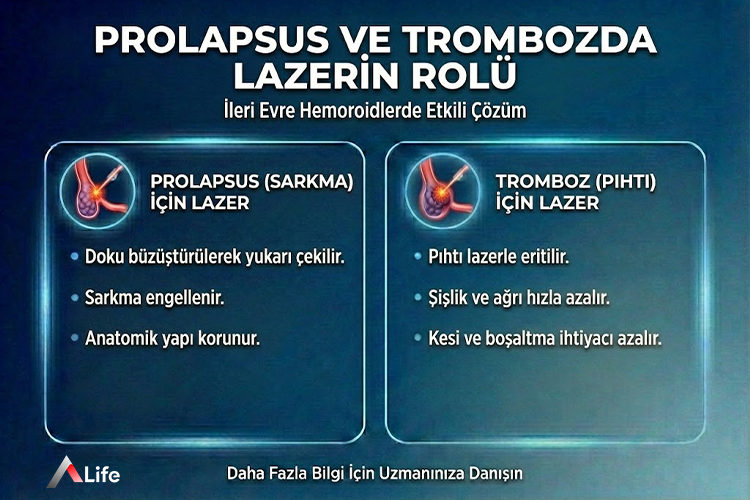 prolapsus-Tromboz_fb0c467c.webp