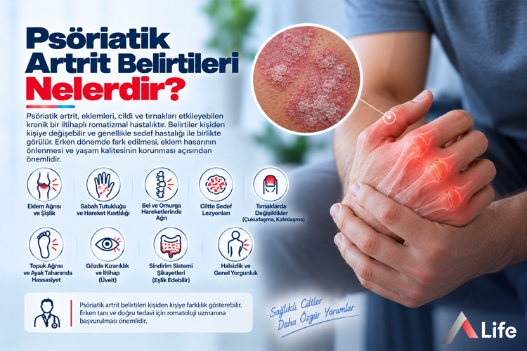 psoriatik-artrit-belirtileri-nelerdir_6936be2c.webp
