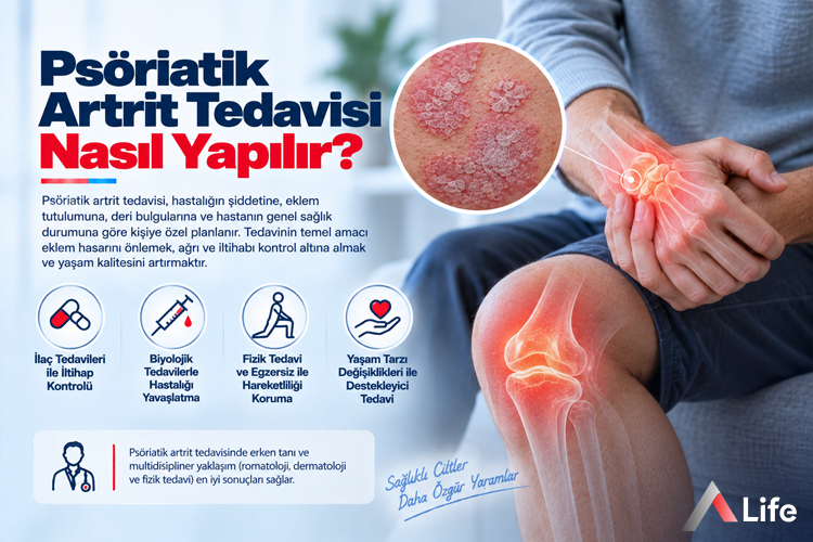 psoriatik-artrit-tedavisi-nasil-yapilir_5ac17a52.webp