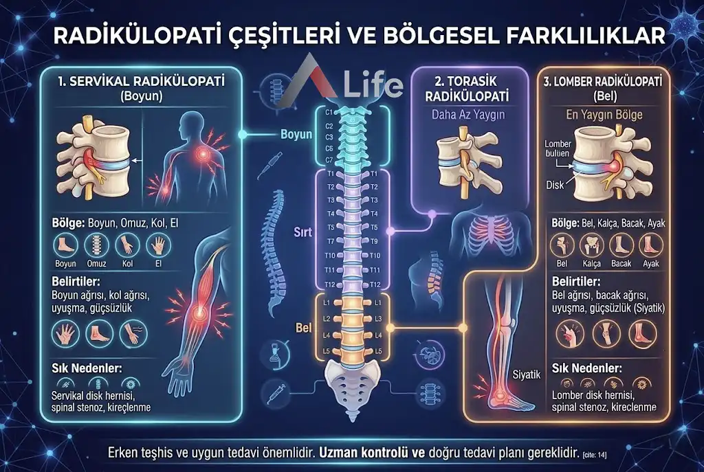 radikulopati-cesitleri-nedir-belirtileri-ve-tani-yontemleri-nelerdir-a-life-ankara_a9691ae5.webp
