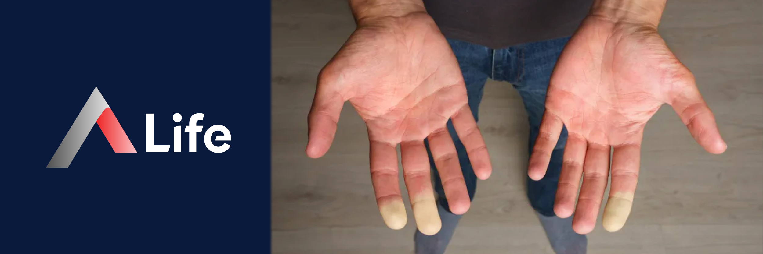 raynaud_hastal_______nedir_435badd2.webp