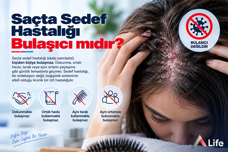 sacta-sedef-hastaligi-bulasici-midir_d28725f1.webp