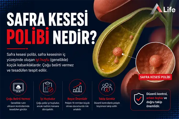 safra-kesesi-polibi-nedir_4d6526b7.webp
