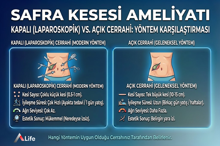 safra_kesesi_ameliyat_kar____la__t__rmas___ef1e8905.webp