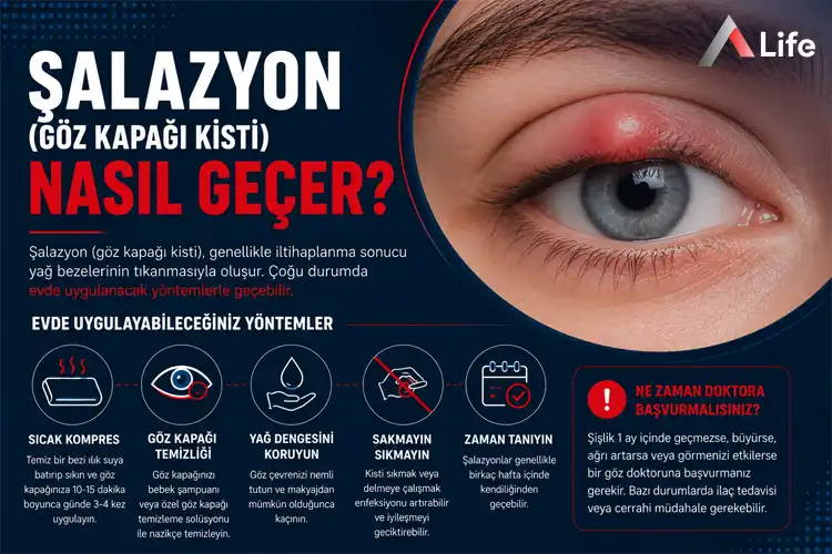 salazyon-goz-kapagi-kisti-nasil-gecer_ee127db4.webp
