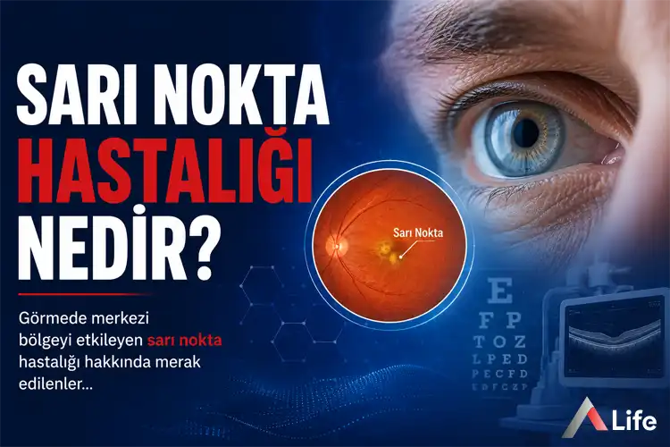 sari-nokta-hastaligi-nedir_8c5c8e34.webp